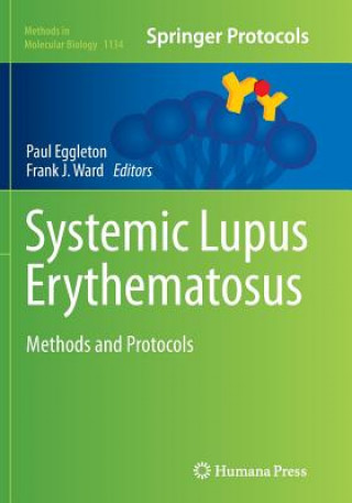 Könyv Systemic Lupus Erythematosus Paul Eggleton