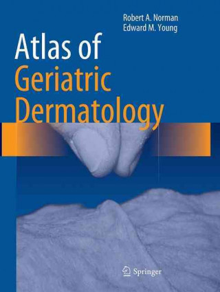 Carte Atlas of Geriatric Dermatology Norman
