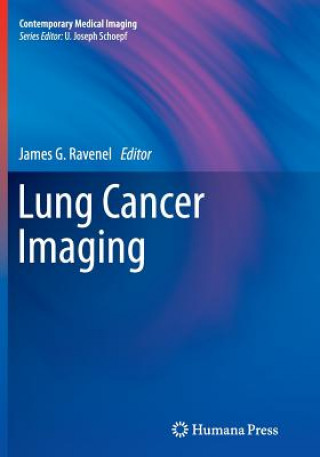 Knjiga Lung Cancer Imaging James G. Ravenel