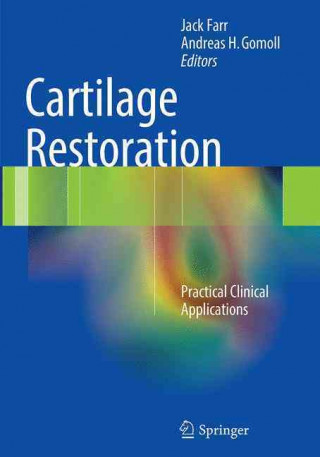 Libro Cartilage Restoration Jack Farr