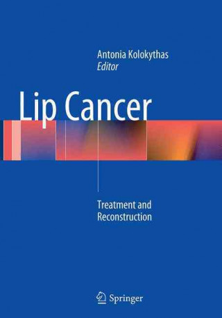 Könyv Lip Cancer Antonia Kolokythas