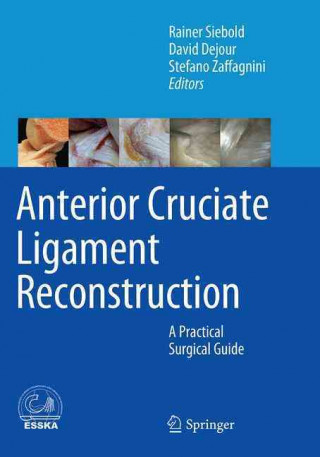 Книга Anterior Cruciate Ligament Reconstruction Rainer Siebold