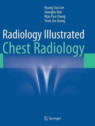 Kniha Radiology Illustrated: Chest Radiology Kyung Soo Lee