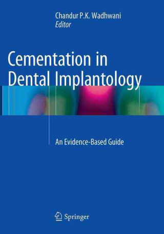 Kniha Cementation in Dental Implantology Chandur P.K. Wadhwani