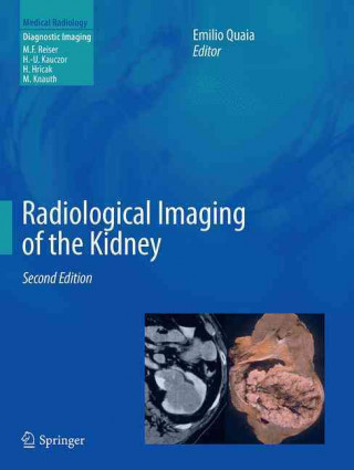 Kniha Radiological Imaging of the Kidney Emilio Quaia