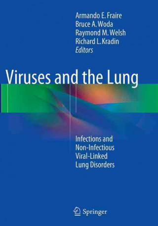 Knjiga Viruses and the Lung Armando E. Fraire