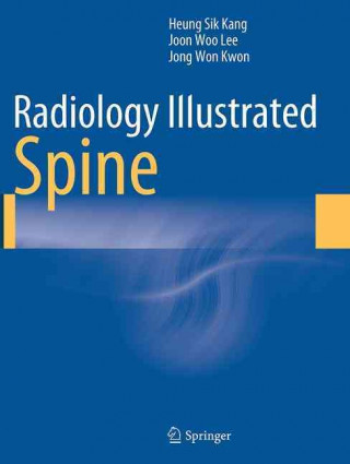 Kniha Radiology Illustrated: Spine Heung Sik Kang