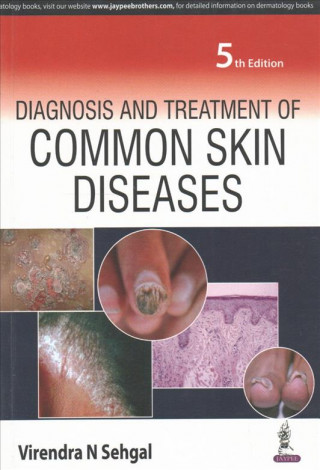 Kniha Diagnosis and Treatment of Common Skin Diseases Virendra N. Sehgal