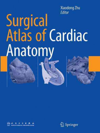 Könyv Surgical Atlas of Cardiac Anatomy Xiaodong Zhu