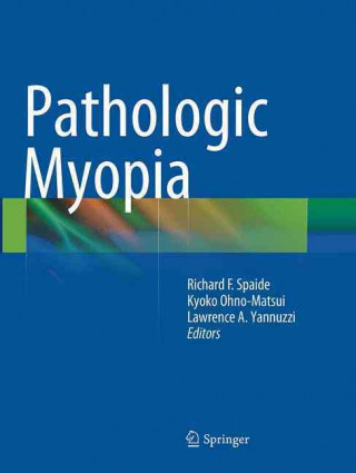 Könyv Pathologic Myopia Richard F. Spaide