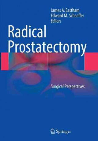 Knjiga Radical Prostatectomy James A. Eastham