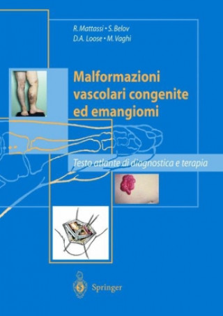 Kniha Malformazioni vascolari congenite ed emangiomi R. Mattassi