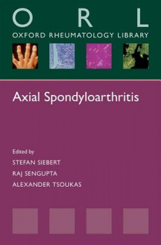 Könyv Axial Spondyloarthritis Stefan Siebert