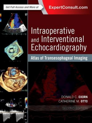 Kniha Intraoperative and Interventional Echocardiography Donald Oxorn
