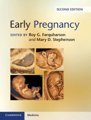 Book Early Pregnancy Roy G. Farquharson