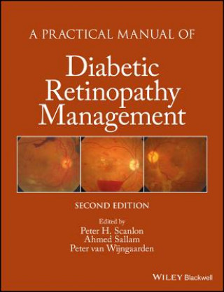 Knjiga Practical Manual of Diabetic Retinopathy Management 2e Peter Scanlon