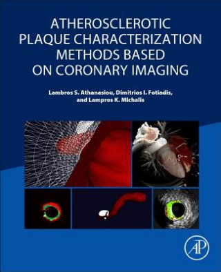 Книга Atherosclerotic Plaque Characterization Methods Based on Coronary Imaging Dimitrios Fotiadis