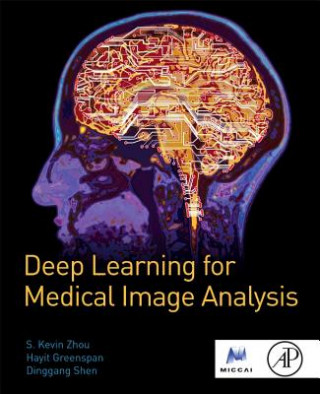 Knjiga Deep Learning for Medical Image Analysis S  Kevin Zhou