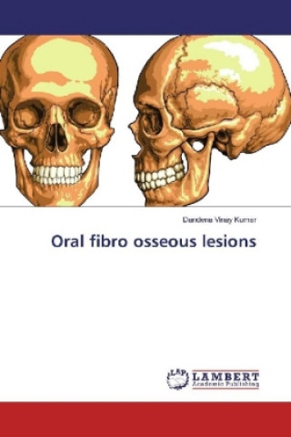 Книга Oral fibro osseous lesions Dandena Vinay Kumar