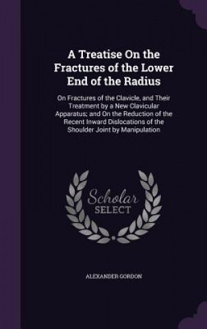 Kniha Treatise on the Fractures of the Lower End of the Radius Alexander Gordon