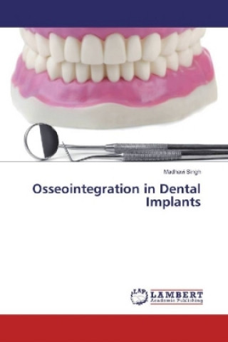 Książka Osseointegration in Dental Implants Madhavi Singh