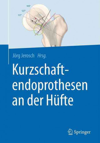 Könyv Kurzschaftendoprothesen an der Hufte Jörg Jerosch