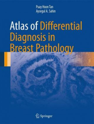 Könyv Atlas of Differential Diagnosis in Breast Pathology Puay Hoon Tan