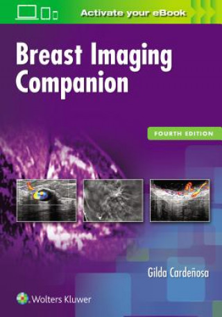 Kniha Breast Imaging Companion Gilda Cardenosa