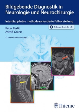 Carte Bildgebende Diagnostik in Neurologie und Neurochirurgie Peter-Dirk Berlit