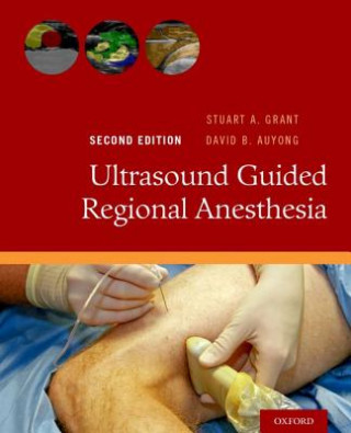 Kniha Ultrasound Guided Regional Anesthesia Stuart A. Grant