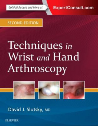 Book Techniques in Wrist and Hand Arthroscopy David J. Slutsky