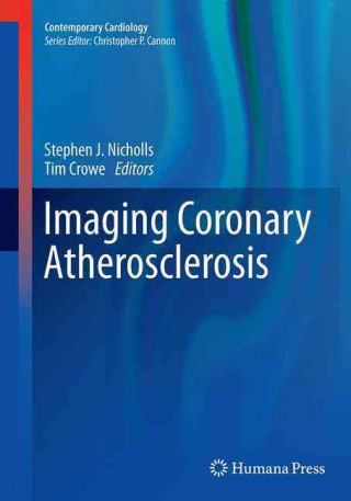 Carte Imaging Coronary Atherosclerosis Stephen J. Nicholls
