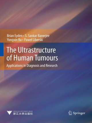 Kniha Ultrastructure of Human Tumours Brian Eyden