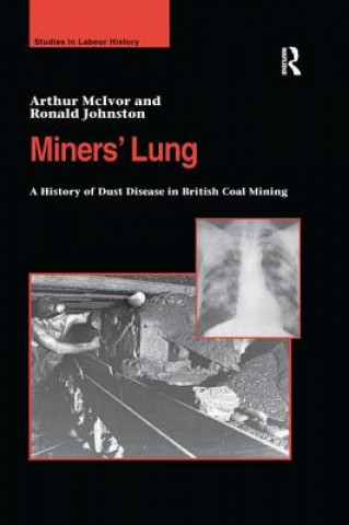 Könyv Miners' Lung MCIVOR
