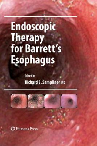 Книга Endoscopic Therapy for Barrett's Esophagus Richard E. Sampliner