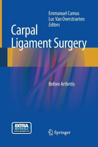 Carte Carpal Ligament Surgery Emmanuel Camus