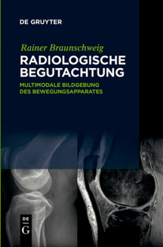Kniha Radiologische Begutachtung Rainer Braunschweig