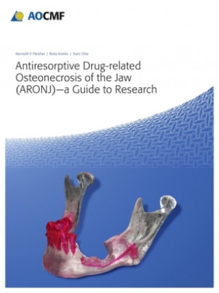 Kniha Antiresorptive Drug-Related Osteonecrosis of the Jaw (ARONJ) - A Guide to Research E. Kenneth Fleisher