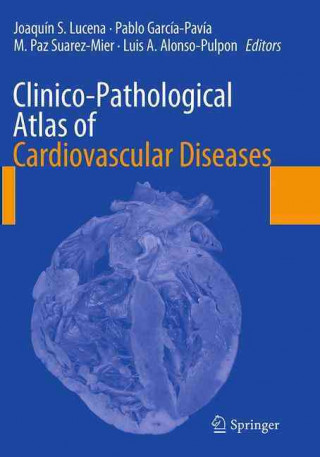 Carte Clinico-Pathological Atlas of Cardiovascular Diseases Joaquín S. Lucena