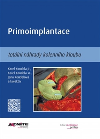 Книга Primoimplantace totální náhrady kolenního kloubu Karel Koudela jr.