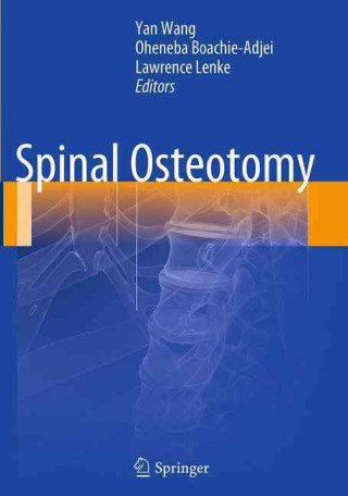 Könyv Spinal Osteotomy Yan Wang