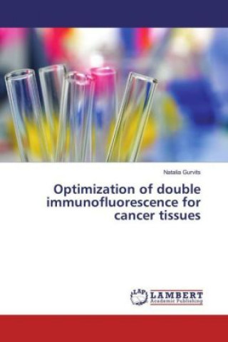 Knjiga Optimization of double immunofluorescence for cancer tissues Natalia Gurvits