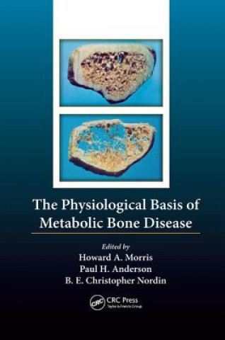 Kniha Physiological Basis of Metabolic Bone Disease 