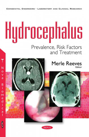 Carte Hydrocephalus Merle Reeves