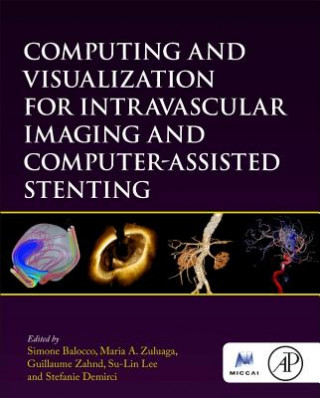 Könyv Computing and Visualization for Intravascular Imaging and Computer-Assisted Stenting Simone Balocco