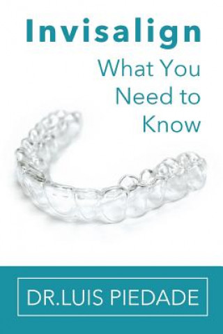 Carte Invisalign: What You Need to Know Dr Luis Piedade