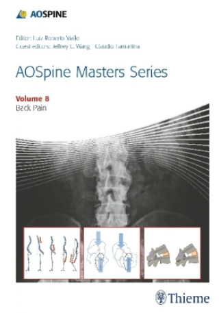 Könyv AOSpine Masters Series, Volume 8: Back Pain Luiz Roberto Gomes Vialle
