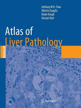 Carte Atlas of Liver Pathology Alberto Quaglia