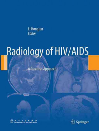 Kniha Radiology of HIV/AIDS Hongjun Li