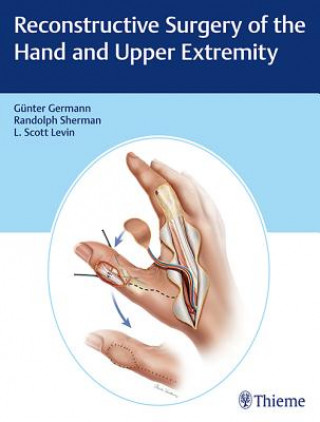 Book Reconstructive Surgery of the Hand and Upper Extremity Günter Germann